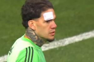 别拍了埃德松被看台异物划伤面部，起身后怒锤贴脸拍的摄像机