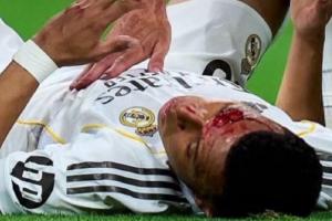 记者：24个摄像头仅1个拍到姆巴佩流血，VAR裁判当时不知道情况